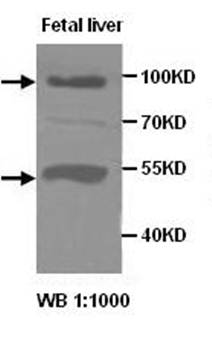 ADAMTS8 Rabbit Polyclonal Antibody