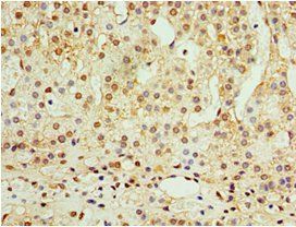 ADAP1 Antibody
