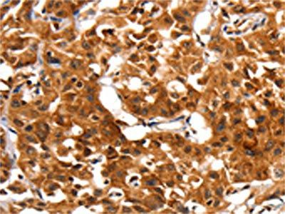 ADAP1 Antibody