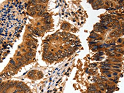 ADAP1 Antibody