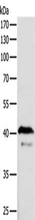 ADAP1 Antibody
