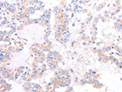 ADAP1 Antibody