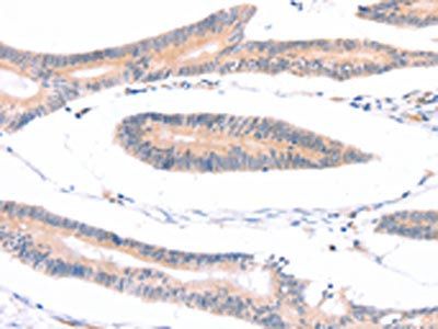 ADAP1 Antibody
