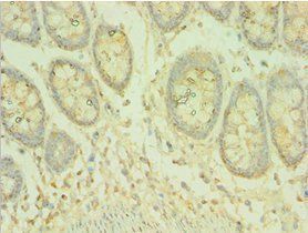 COQ8A Antibody