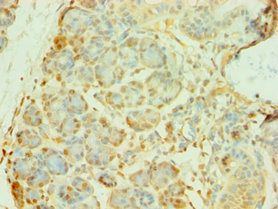 COQ8A Antibody