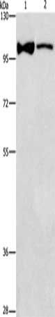 ADCY3 Antibody