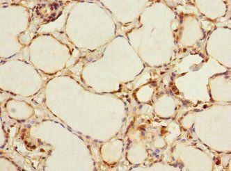 ADCY4 Antibody