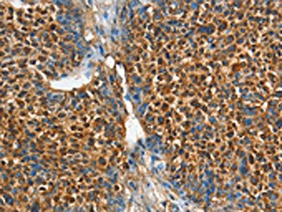 ADCY4 Antibody