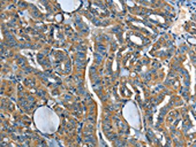 ADCY4 Antibody