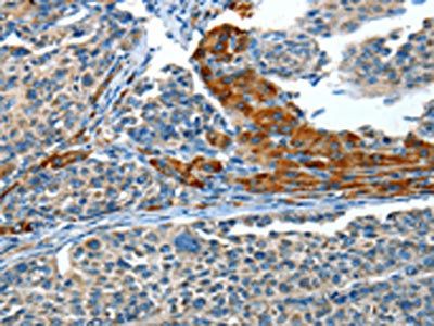 ADCY4 Antibody