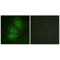 ADCY6/ADCY5 Antibody