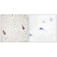 ADCY6/ADCY5 Antibody