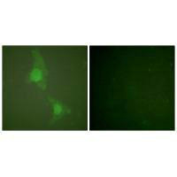 ADD1 Antibody