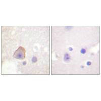 ADD1 Antibody