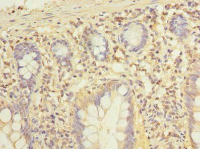 ADGRL4 Antibody