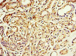 ADH1C Antibody