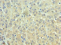 ADH1C Antibody