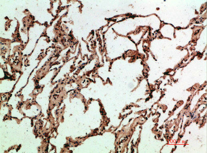 ADI1 Antibody