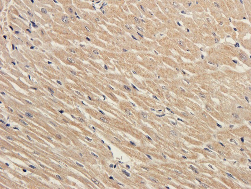 Adiponectin antibody