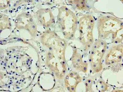 ADM Antibody