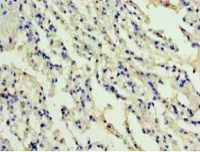 ADM Antibody