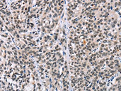 ADNP Antibody