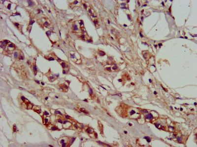 ADO Antibody