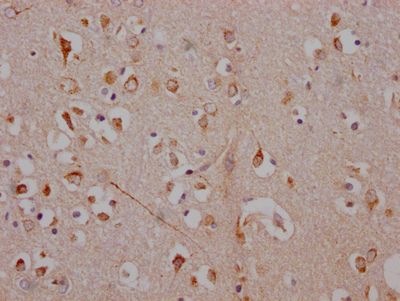 ADORA1 Antibody