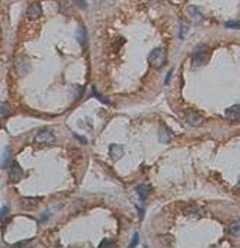 ADORA1 Rabbit Polyclonal Antibody
