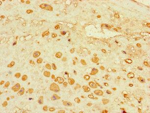 ADORA2A Antibody
