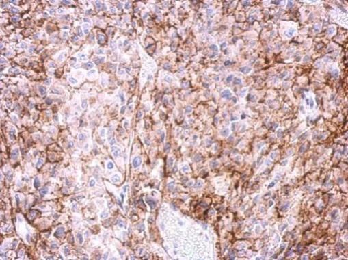 adenosine A2a receptor Antibody