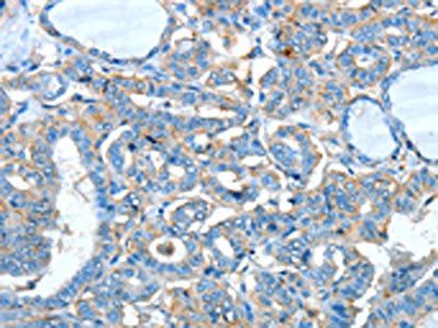 ADRA1A Antibody