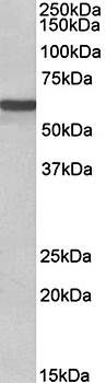 ADRA1B Antibody