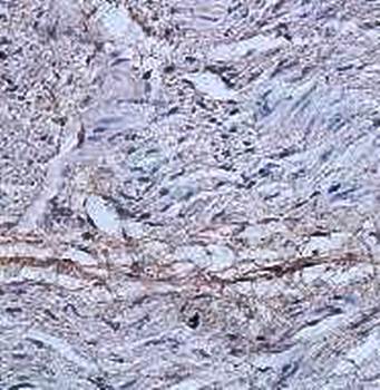 ADRBK2 Rabbit Polyclonal Antibody