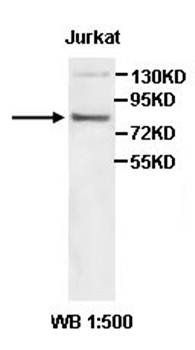 ADRBK2 Rabbit Polyclonal Antibody