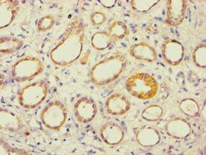 AES Antibody