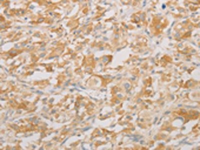 AES Antibody