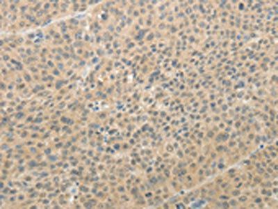 AFF2 Antibody