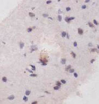 AFF2 Rabbit Polyclonal Antibody