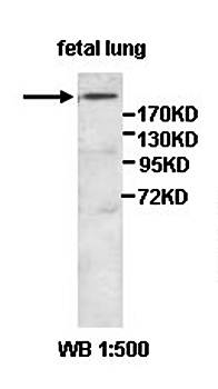 AFF2 Rabbit Polyclonal Antibody