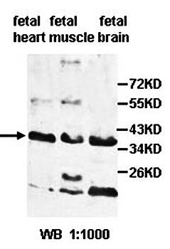 AGA Rabbit Polyclonal Antibody