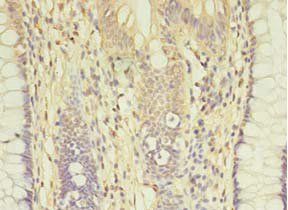 AGBL2 Antibody