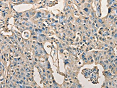AGBL2 Antibody