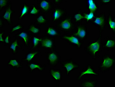 AGL Antibody