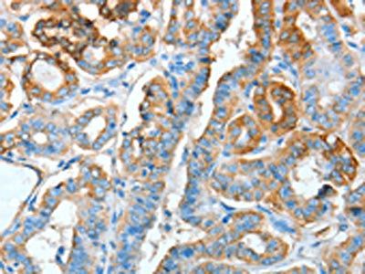 AGR3 Antibody