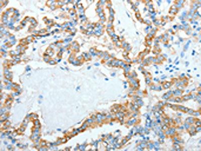 AGR3 Antibody