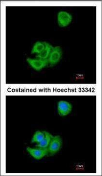 AGR3 Rabbit Polyclonal Antibody