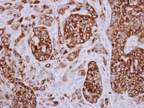 AGR3 Rabbit Polyclonal Antibody