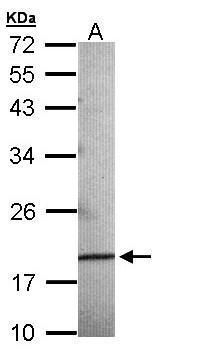 AGR3 Rabbit Polyclonal Antibody