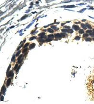 AGR3 Rabbit Polyclonal Antibody